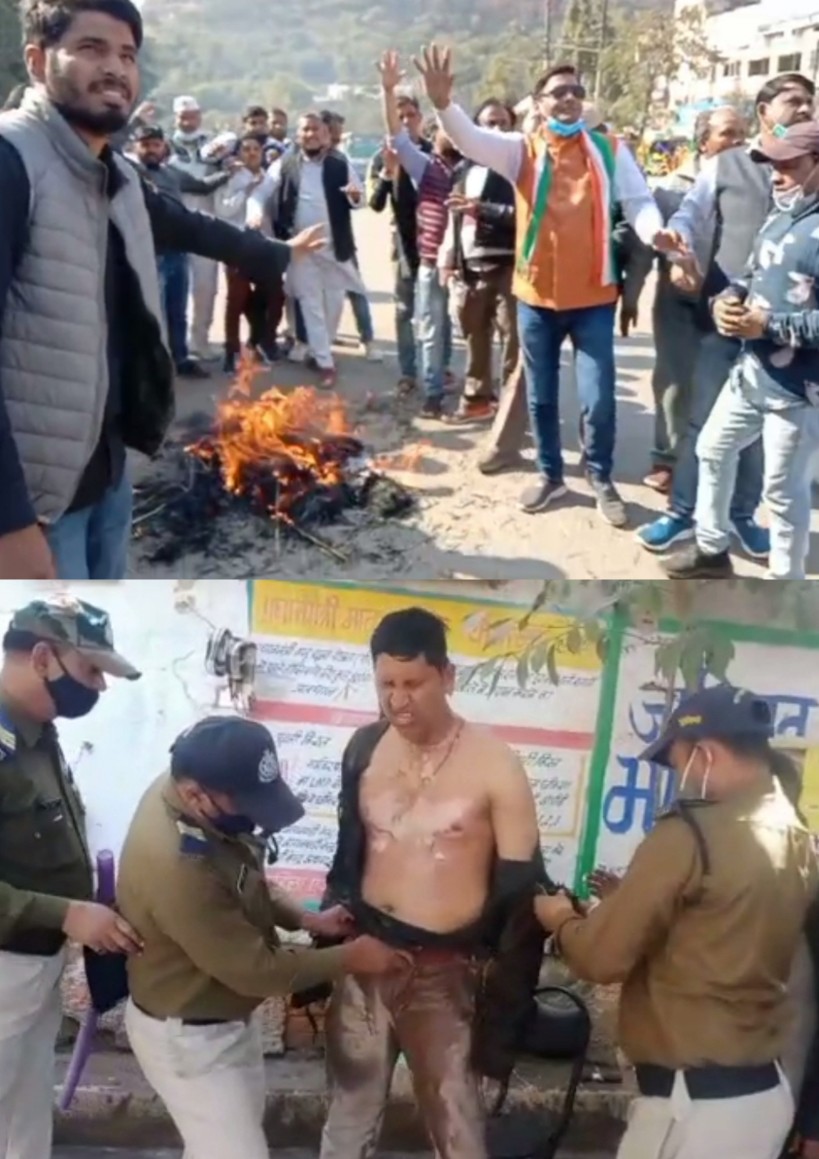 कांग्रेस ने किया सरकार का पुतला दहन सब इंस्पेक्टर दीपक गौतम जले गंभीर हालत में कराया अस्पताल में भर्ती