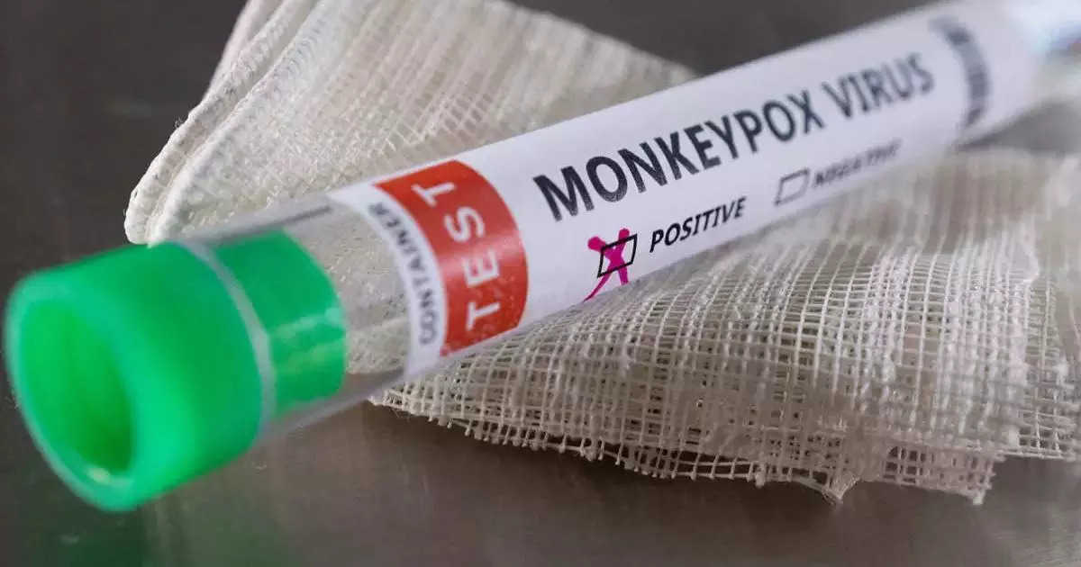Monkeypox in Delhi: मंकीपॉक्स का दिल्ली में तीसरा मामला, एक और नाइजीरियाई व्यक्ति में संक्रमण की पुष्टि